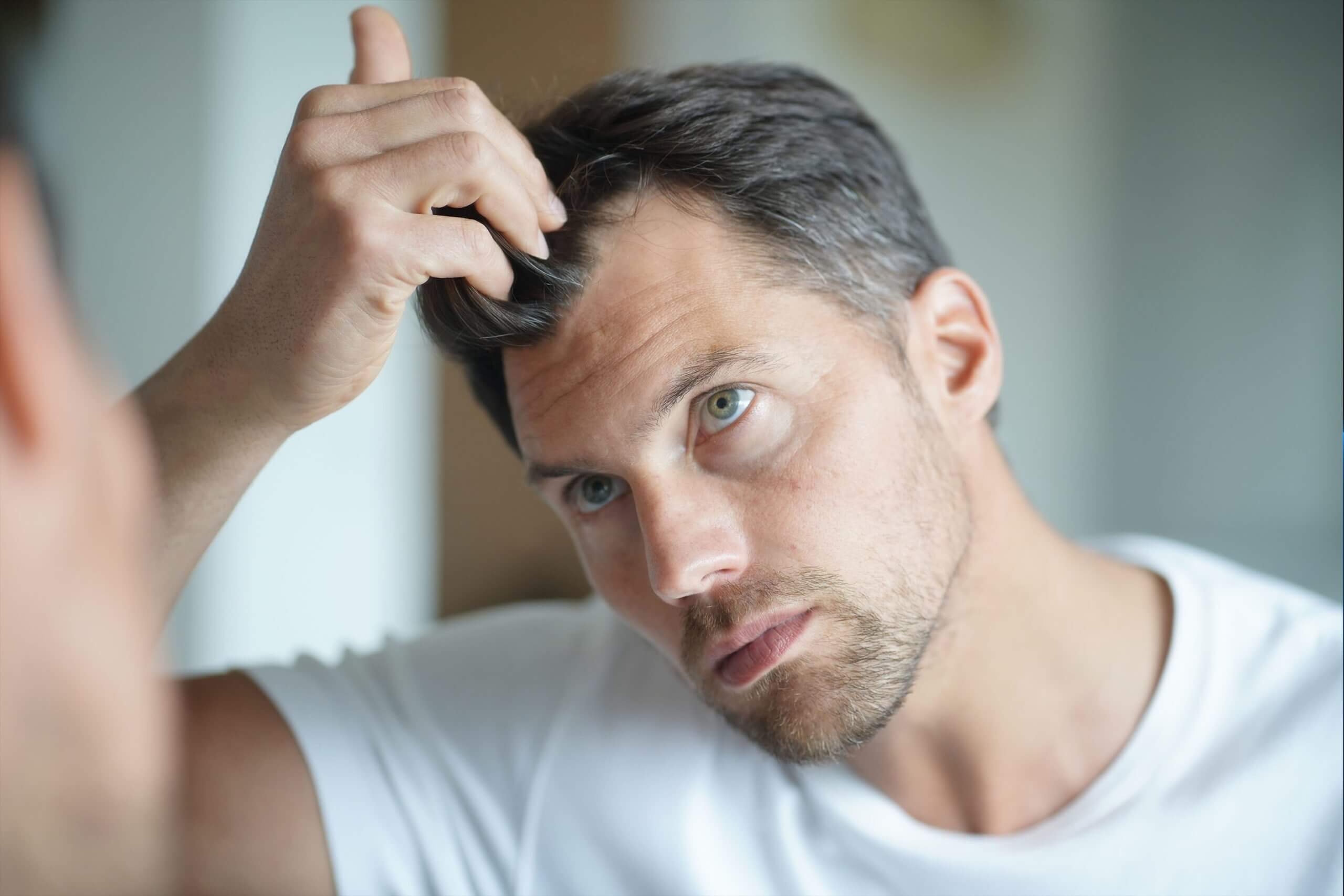 4 Reasons Why Your Hairline Might Be Receding - And How Xtrallux Can Help