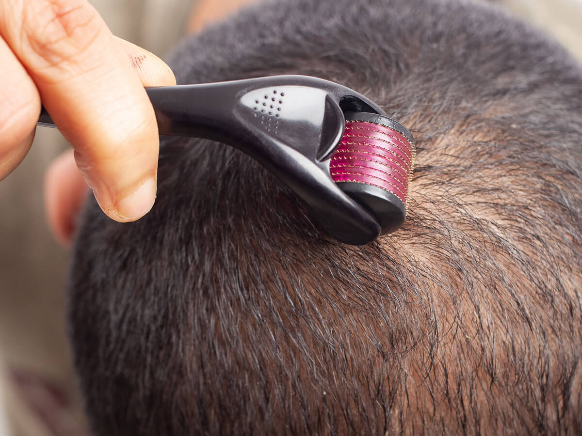 Microneedling and Laser Caps: How to Combine Them Safely