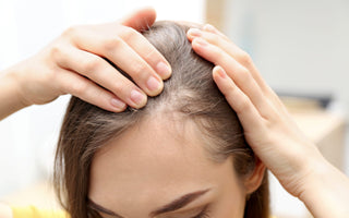 Understanding the Ludwig Scale: Navigating Through Female Pattern Hair Loss