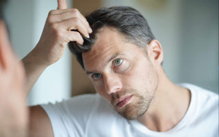 4 Reasons Why Your Hairline Might Be Receding - And How Xtrallux Can Help