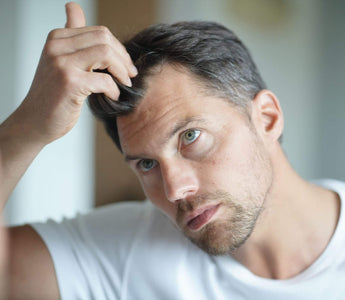 4 Reasons Why Your Hairline Might Be Receding - And How Xtrallux Can Help