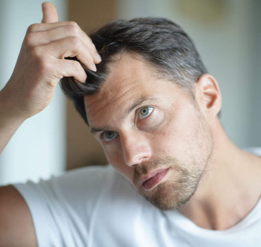 4 Reasons Why Your Hairline Might Be Receding - And How Xtrallux Can Help