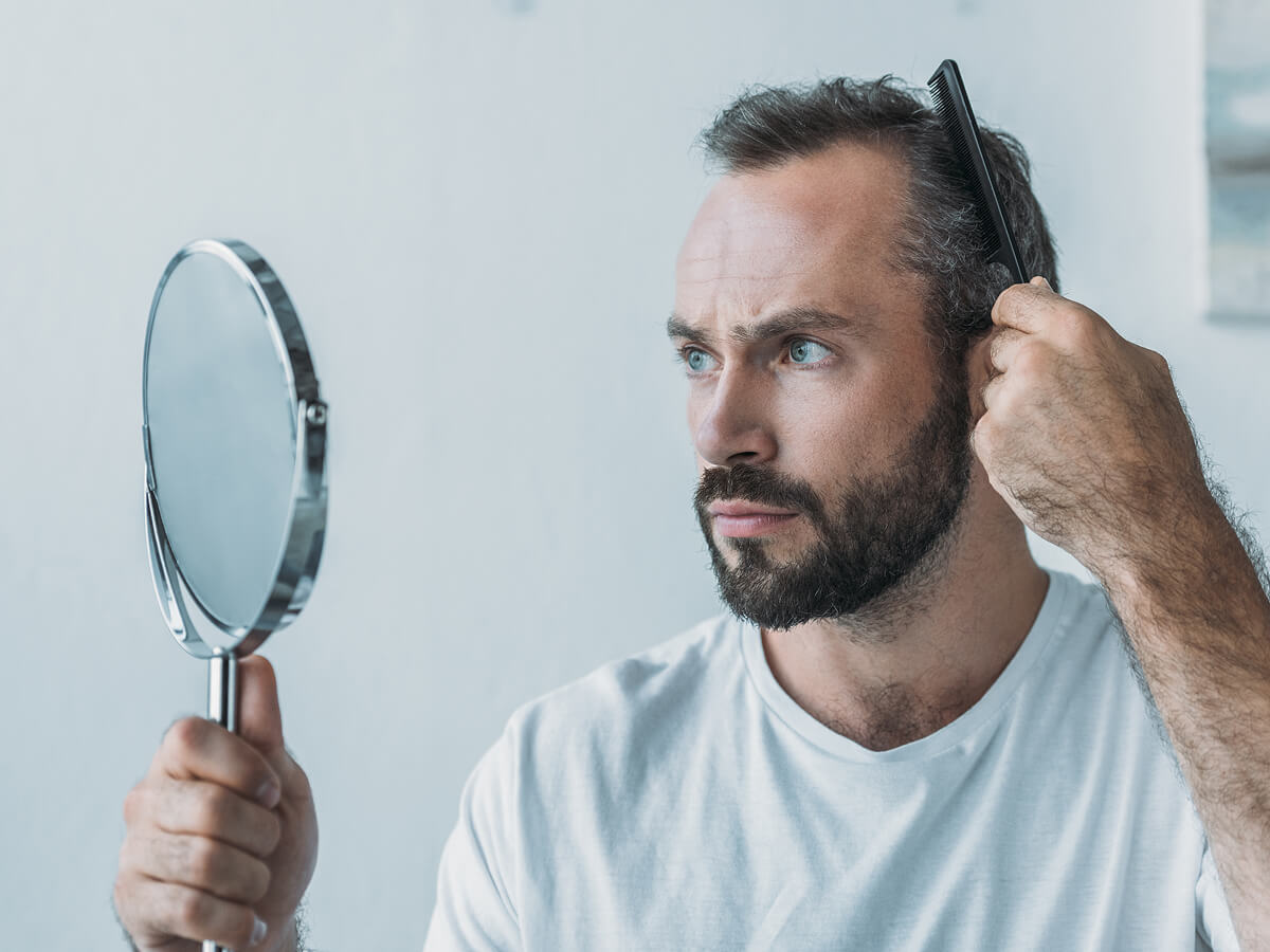 Early Signs of Balding Most People Ignore: A Guide to Catching It Early