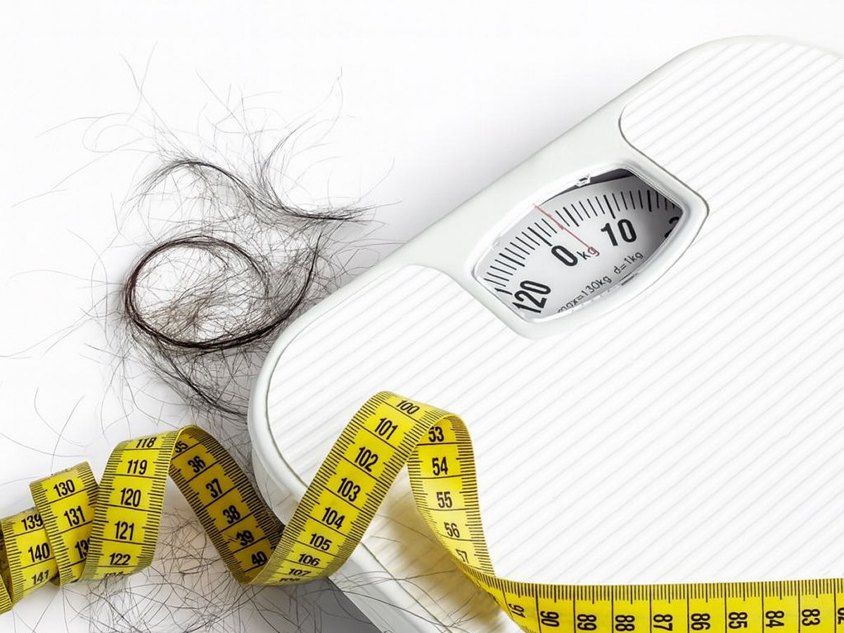 Do Weight Loss Drugs Like Ozempic Cause Hair Loss?