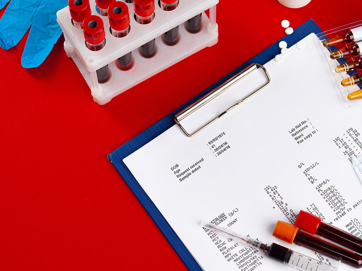 Hair Loss Lab Checklist: Tests to Ask For Before You Guess