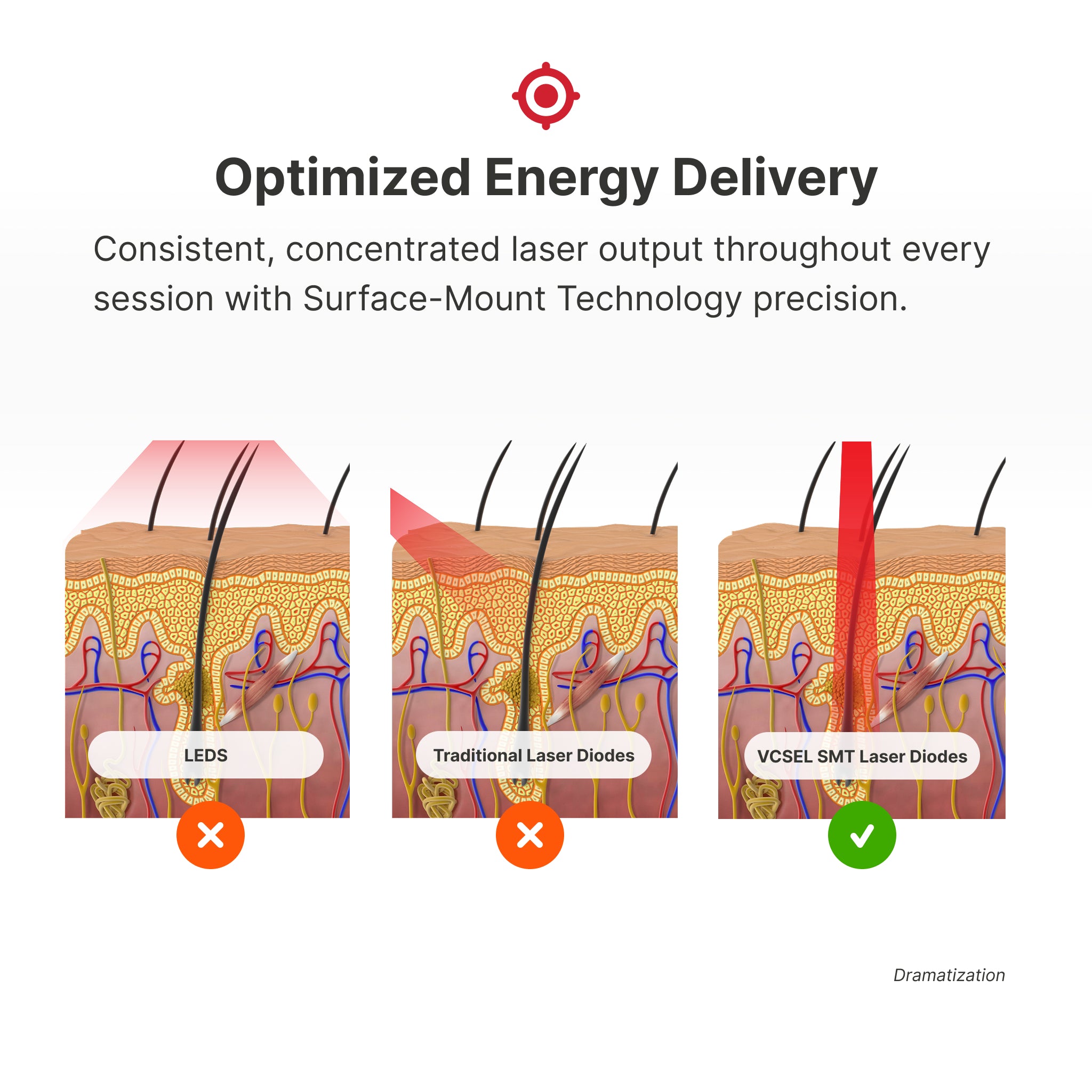 Diagram comparing LEDS, traditional laser diodes, and VCSEL SMT laser diodes for optimized energy delivery.