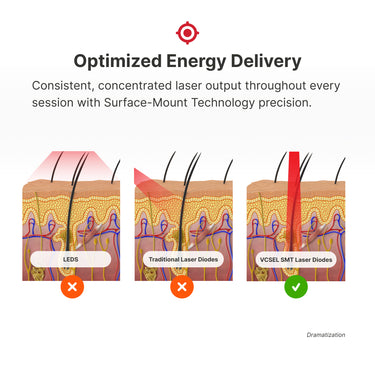 Diagram comparing LEDS, traditional laser diodes, and VCSEL SMT laser diodes for optimized energy delivery.
